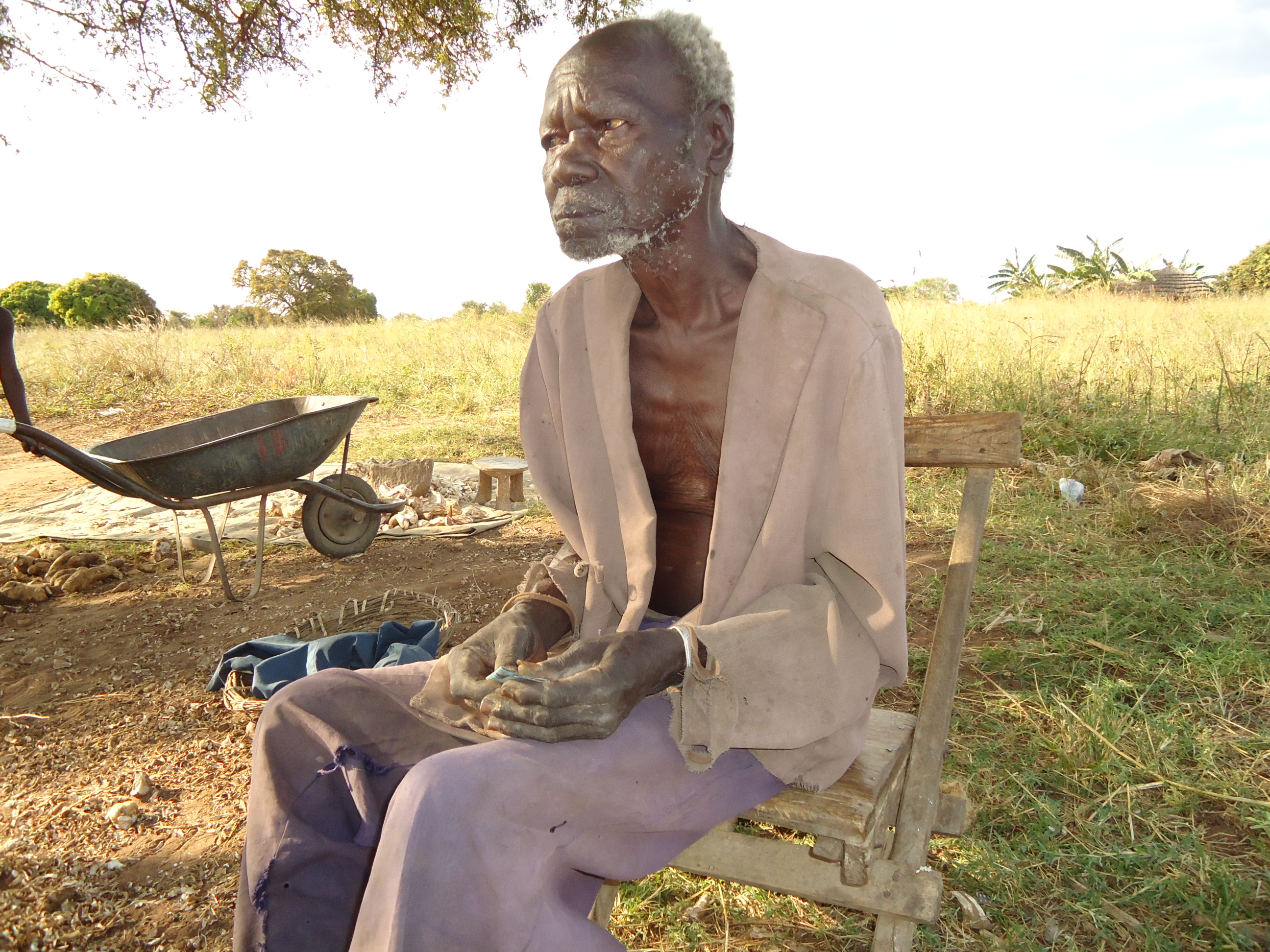 DSC00551 An Old Man Riddled with Jiggers in Katakwi District, Uganda